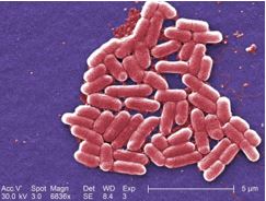 大腸菌の電子顕微鏡写真  （©Janice Harvey Carr、疾病管理センター） 
